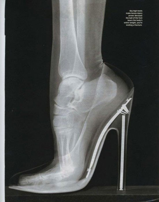 ladies thats what happens to your foot